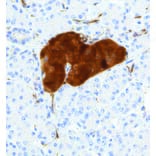 Immunohistochemistry - Anti-NSE Antibody [IHC641] (A324423) - Antibodies.com