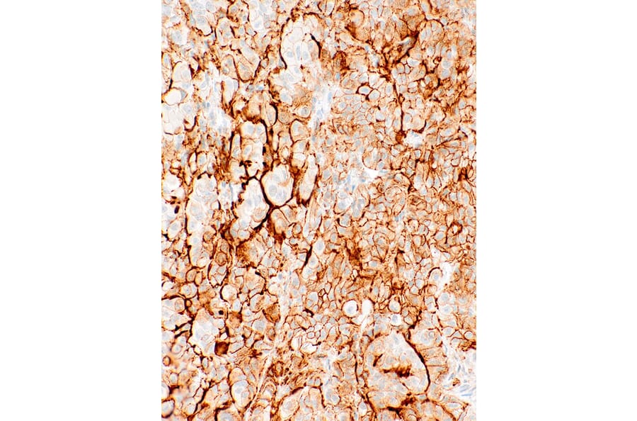 Immunohistochemistry - Anti-Podoplanin Antibody [IHC650] (A324424) - Antibodies.com