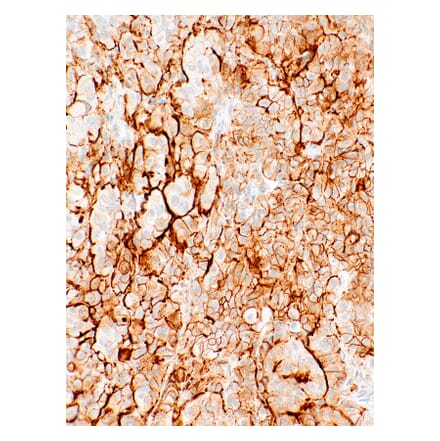 Immunohistochemistry - Anti-Podoplanin Antibody [IHC650] (A324424) - Antibodies.com