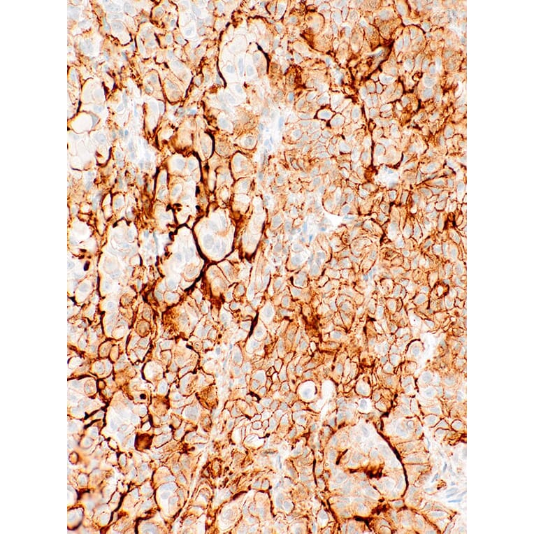 Immunohistochemistry - Anti-Podoplanin Antibody [IHC650] (A324424) - Antibodies.com