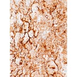 Immunohistochemistry - Anti-Podoplanin Antibody [IHC650] (A324424) - Antibodies.com