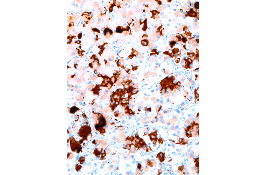 Immunohistochemistry - Anti-Prolactin/PRL Antibody [IHC652] (A324426) - Antibodies.com