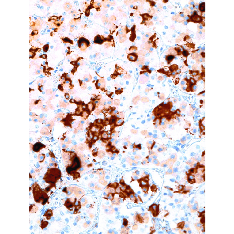 Immunohistochemistry - Anti-Prolactin/PRL Antibody [IHC652] (A324426) - Antibodies.com