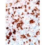 Immunohistochemistry - Anti-Prolactin/PRL Antibody [IHC652] (A324426) - Antibodies.com