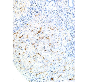 Immunohistochemistry - Anti-ABCB4 Antibody [IHC621] (A324428) - Antibodies.com