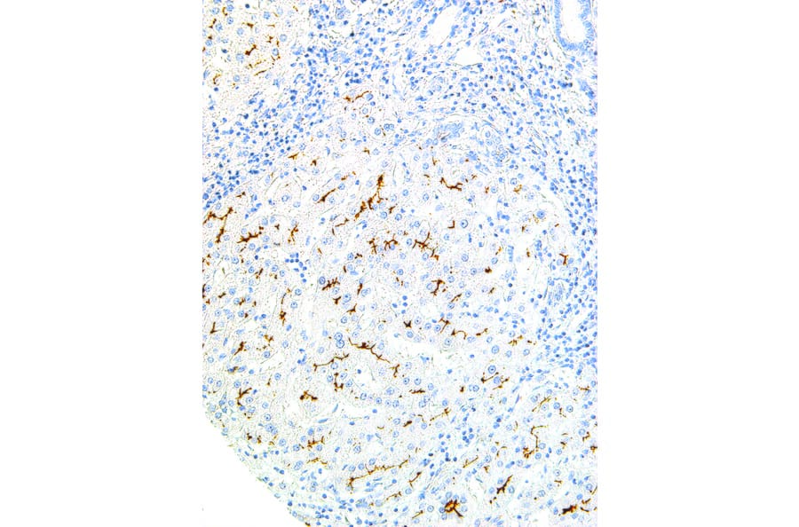 Immunohistochemistry - Anti-ABCB4 Antibody [IHC621] (A324428) - Antibodies.com