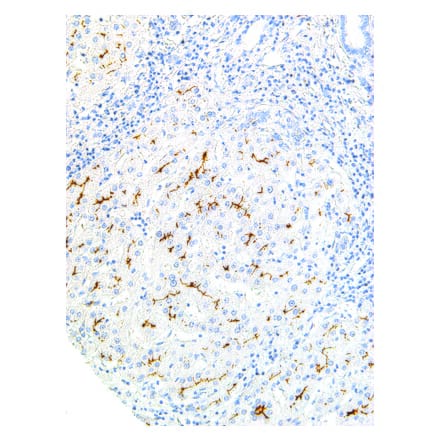 Immunohistochemistry - Anti-ABCB4 Antibody [IHC621] (A324428) - Antibodies.com