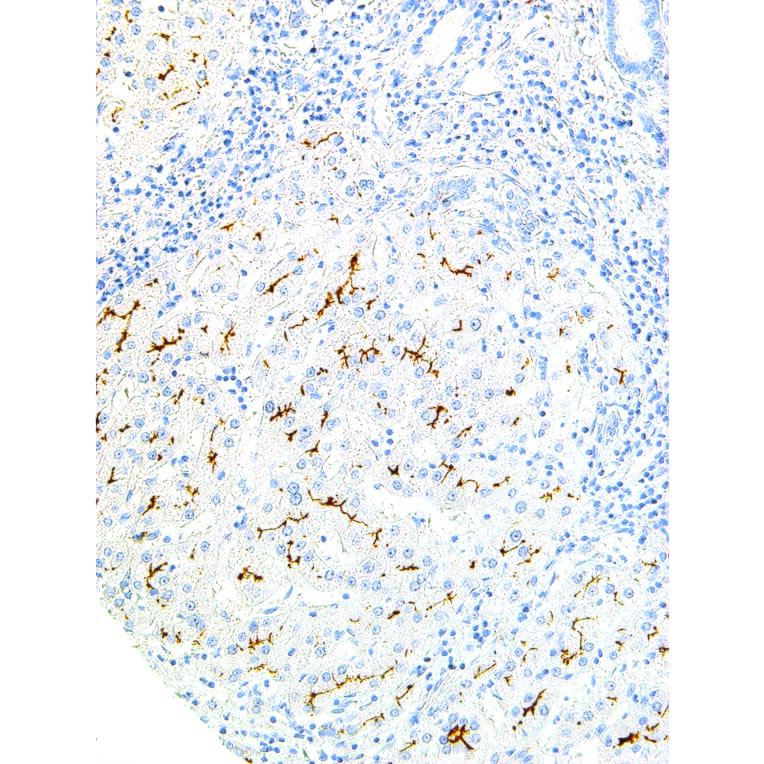 Immunohistochemistry - Anti-ABCB4 Antibody [IHC621] (A324428) - Antibodies.com