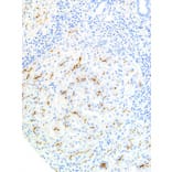 Immunohistochemistry - Anti-ABCB4 Antibody [IHC621] (A324428) - Antibodies.com