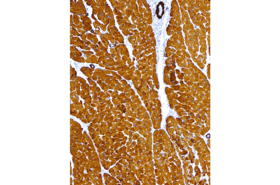 Immunohistochemistry - Anti-alpha Skeletal Muscle Actin Antibody [IHC505] (A324429) - Antibodies.com