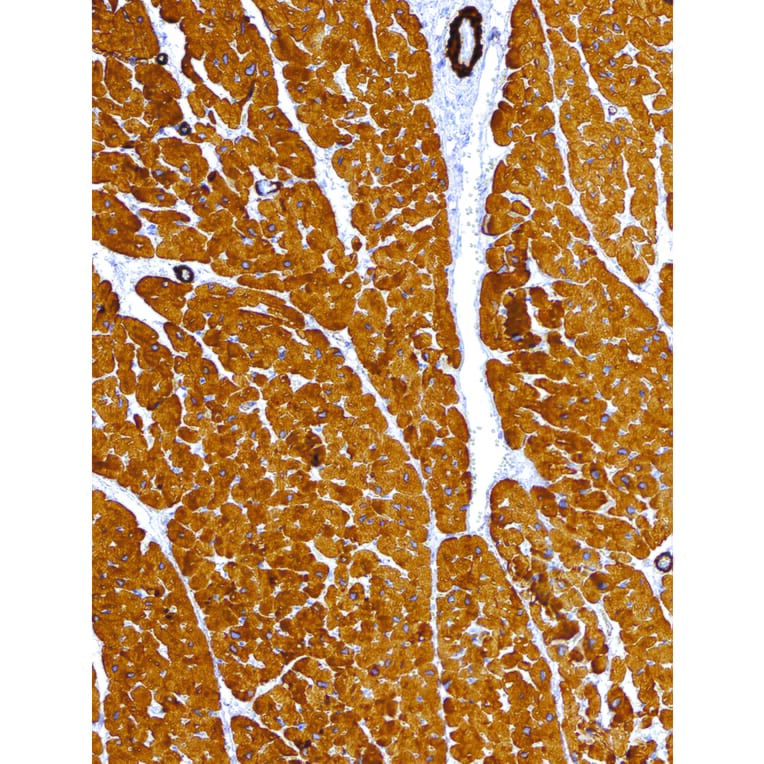 Immunohistochemistry - Anti-alpha Skeletal Muscle Actin Antibody [IHC505] (A324429) - Antibodies.com