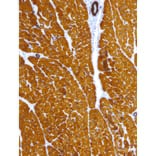 Immunohistochemistry - Anti-alpha Skeletal Muscle Actin Antibody [IHC505] (A324429) - Antibodies.com