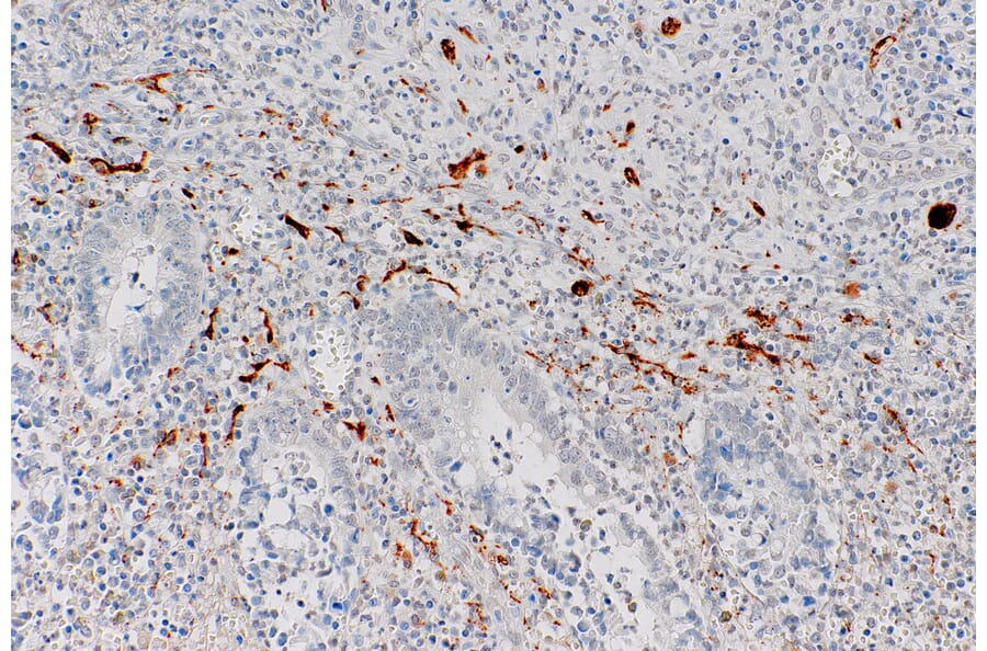 Immunohistochemistry - Anti-Calretinin Antibody [IHC523] (A324434) - Antibodies.com