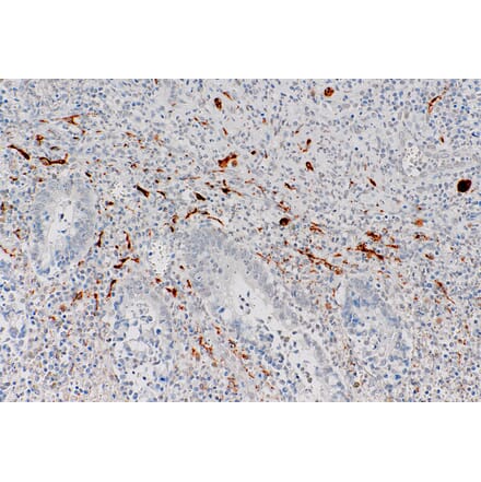 Immunohistochemistry - Anti-Calretinin Antibody [IHC523] (A324434) - Antibodies.com