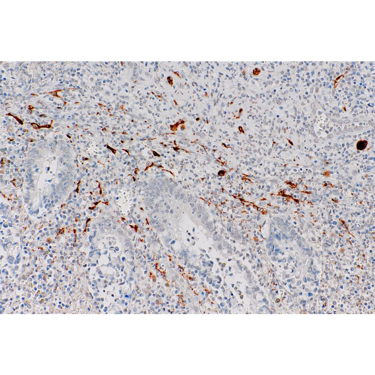 Immunohistochemistry - Anti-Calretinin Antibody [IHC523] (A324434) - Antibodies.com