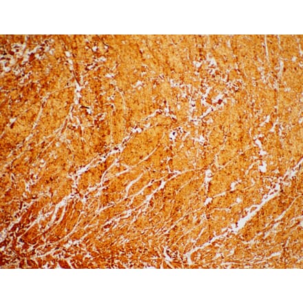 Immunohistochemistry - Anti-Cardiac Troponin I Antibody [IHC271] (A324436) - Antibodies.com