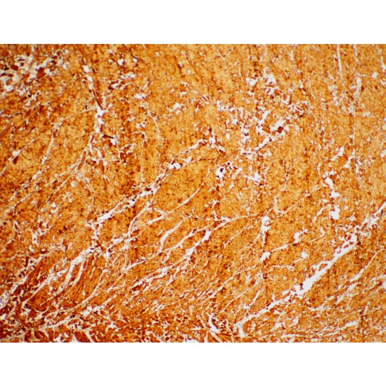Immunohistochemistry - Anti-Cardiac Troponin I Antibody [IHC271] (A324436) - Antibodies.com