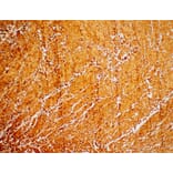 Immunohistochemistry - Anti-Cardiac Troponin I Antibody [IHC271] (A324436) - Antibodies.com