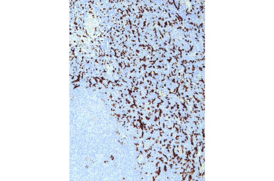 Immunohistochemistry - Anti-CD163 Antibody [IHC163] (A324437) - Antibodies.com