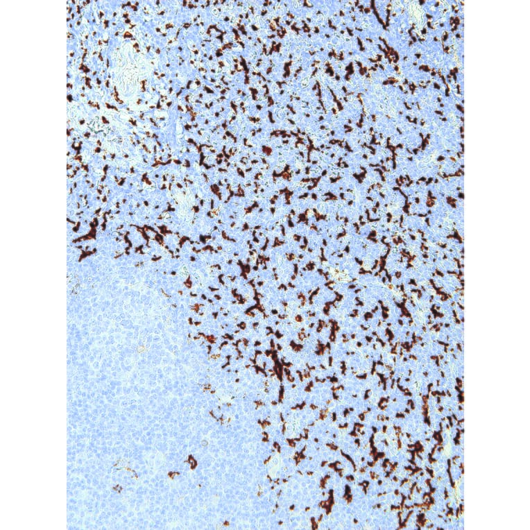 Immunohistochemistry - Anti-CD163 Antibody [IHC163] (A324437) - Antibodies.com