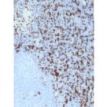 Immunohistochemistry - Anti-CD163 Antibody [IHC163] (A324437) - Antibodies.com