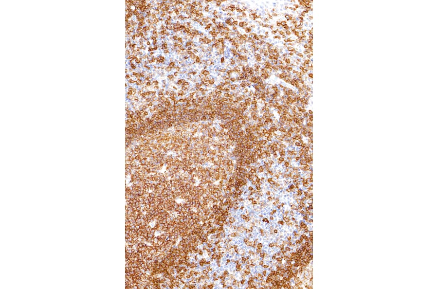 Immunohistochemistry - Anti-CD19 Antibody [IHC529] (A324438) - Antibodies.com