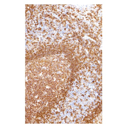 Immunohistochemistry - Anti-CD19 Antibody [IHC529] (A324438) - Antibodies.com