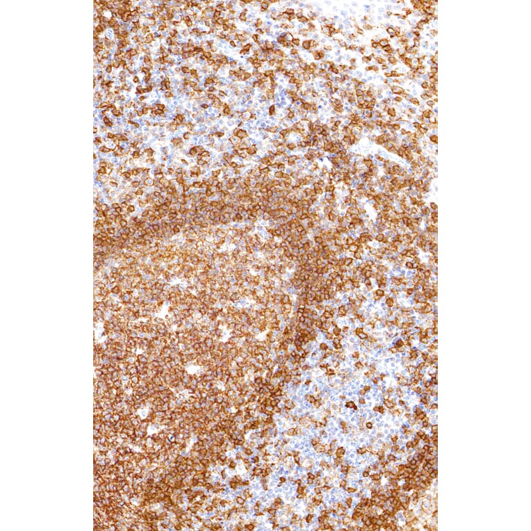 Immunohistochemistry - Anti-CD19 Antibody [IHC529] (A324438) - Antibodies.com