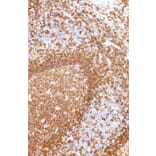 Immunohistochemistry - Anti-CD19 Antibody [IHC529] (A324438) - Antibodies.com