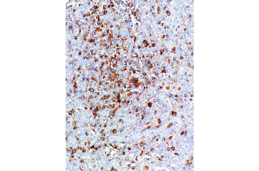 Immunohistochemistry - Anti-CD30 Antibody [IHC130] (A324439) - Antibodies.com