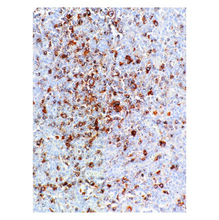 Immunohistochemistry - Anti-CD30 Antibody [IHC130] (A324439) - Antibodies.com