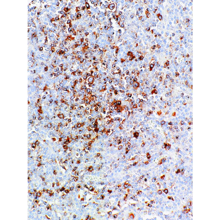 Immunohistochemistry - Anti-CD30 Antibody [IHC130] (A324439) - Antibodies.com