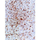 Immunohistochemistry - Anti-CD30 Antibody [IHC130] (A324439) - Antibodies.com