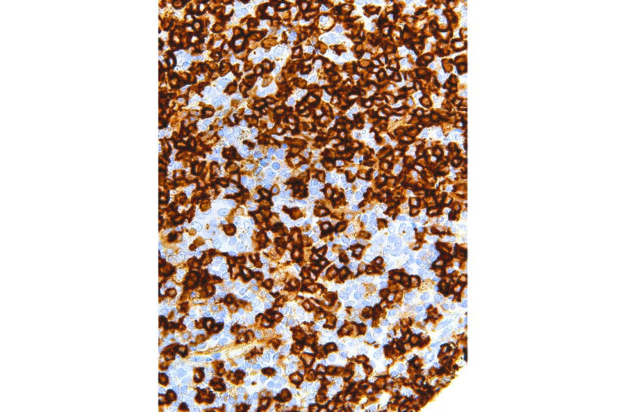 Immunohistochemistry - Anti-CD45RA Antibody [IHC536] (A324443) - Antibodies.com