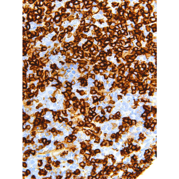 Immunohistochemistry - Anti-CD45RA Antibody [IHC536] (A324443) - Antibodies.com