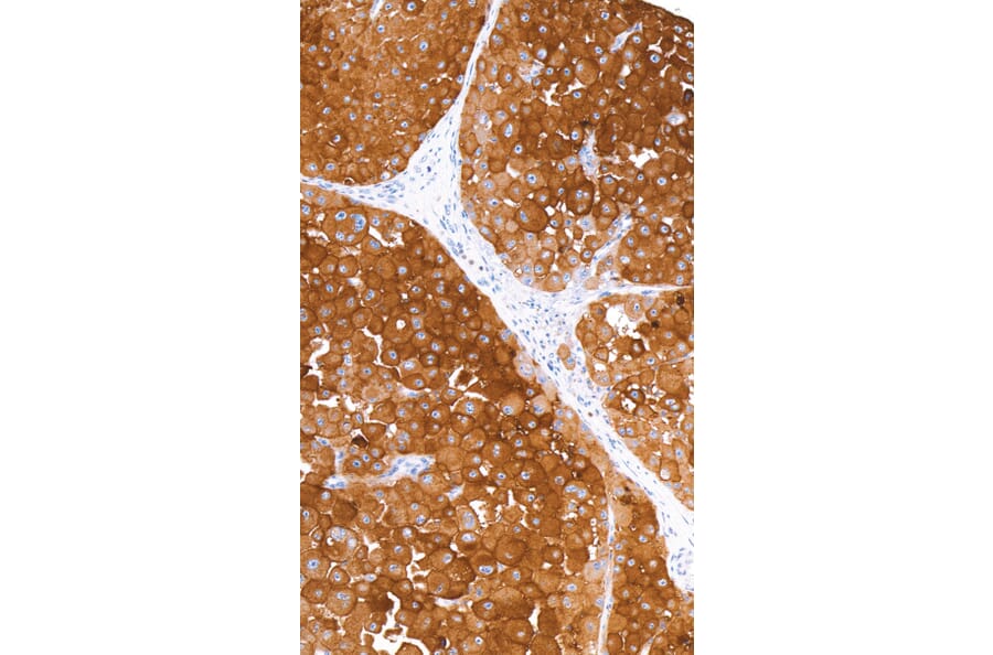Immunohistochemistry - Anti-CD63 Antibody [IHC540] (A324444) - Antibodies.com