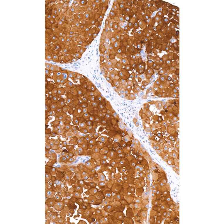 Immunohistochemistry - Anti-CD63 Antibody [IHC540] (A324444) - Antibodies.com