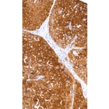 Immunohistochemistry - Anti-CD63 Antibody [IHC540] (A324444) - Antibodies.com