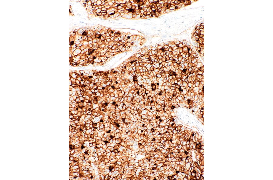 Immunohistochemistry - Anti-CD73 Antibody [IHC073] (A324445) - Antibodies.com