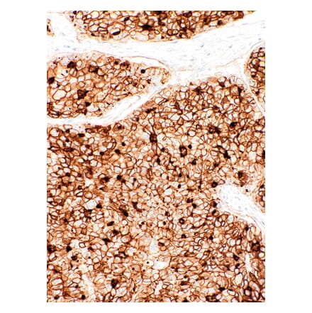 Immunohistochemistry - Anti-CD73 Antibody [IHC073] (A324445) - Antibodies.com