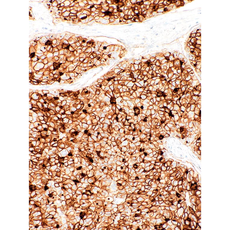 Immunohistochemistry - Anti-CD73 Antibody [IHC073] (A324445) - Antibodies.com