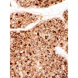 Immunohistochemistry - Anti-CD73 Antibody [IHC073] (A324445) - Antibodies.com