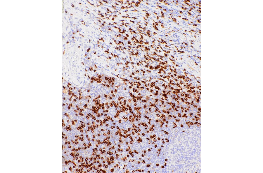 Immunohistochemistry - Anti-CD8 alpha Antibody [IHC542] (A324446) - Antibodies.com