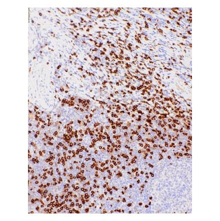 Immunohistochemistry - Anti-CD8 alpha Antibody [IHC542] (A324446) - Antibodies.com