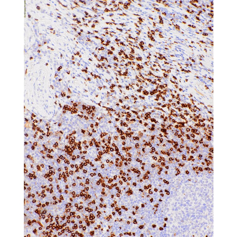 Immunohistochemistry - Anti-CD8 alpha Antibody [IHC542] (A324446) - Antibodies.com