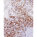 Immunohistochemistry - Anti-CD8 alpha Antibody [IHC542] (A324446) - Antibodies.com