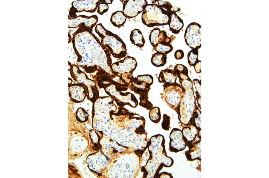 Immunohistochemistry - Anti-CGA/hCG alpha Antibody [IHC593] (A324448) - Antibodies.com