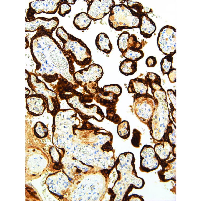 Immunohistochemistry - Anti-CGA/hCG alpha Antibody [IHC593] (A324448) - Antibodies.com