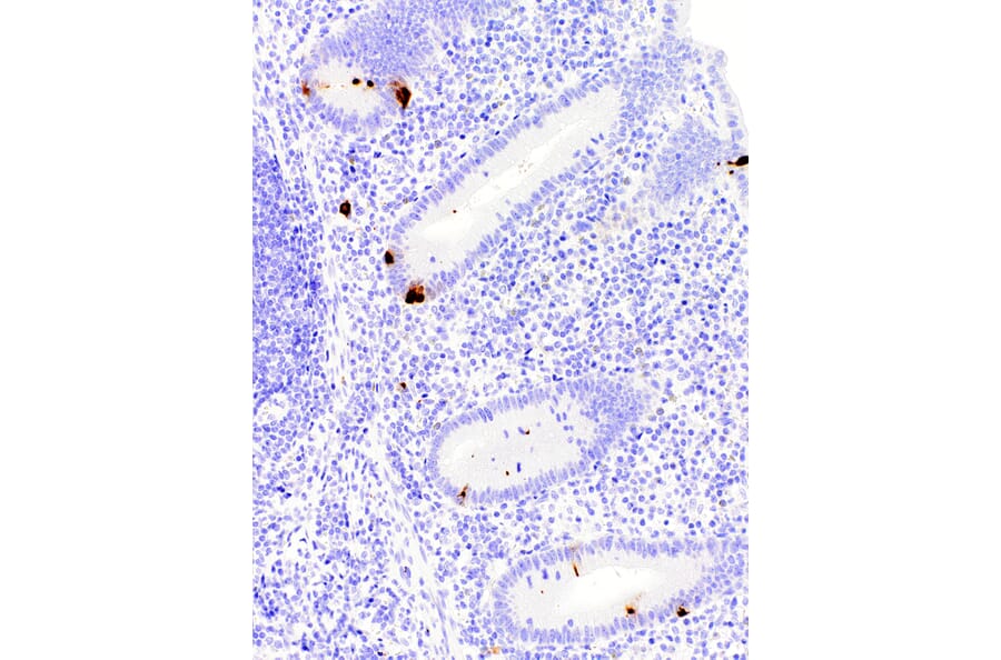 Immunohistochemistry - Anti-Chromogranin A Antibody [IHC544] (A324449) - Antibodies.com