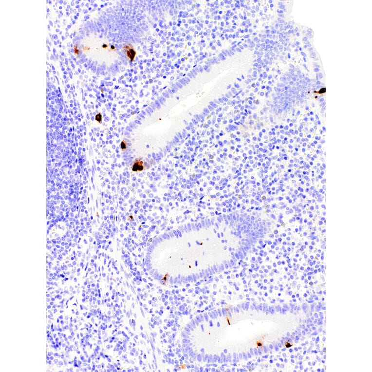 Immunohistochemistry - Anti-Chromogranin A Antibody [IHC544] (A324449) - Antibodies.com